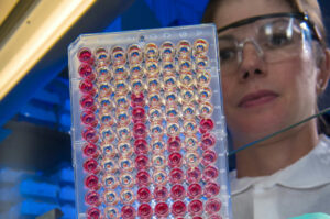 12 – Immunodétection