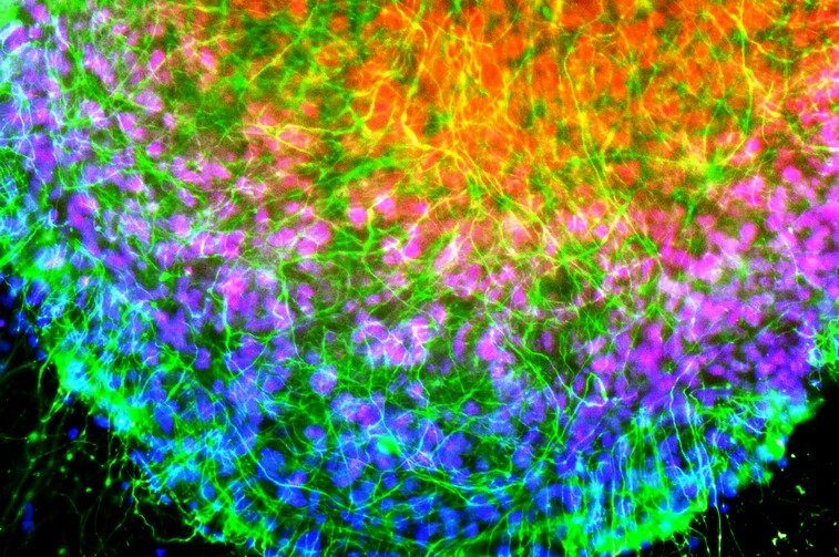 22 – La microscopie à expansion